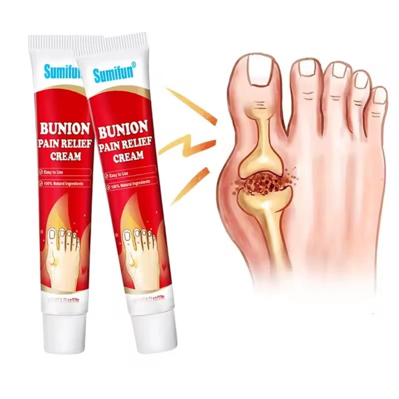 Sumifun 20g Foot Gout Treatment Cream Thumb Corrector Finger Hallux Ointment Toe Bunion Pain Relief Medical Plaster Health Care