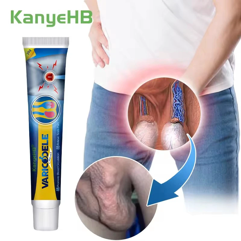 Varicocele Treatment Ointment Male Varicose Veins Cream Scrotum Varicosity Ointment Man Scrotal Pain Relief Cream