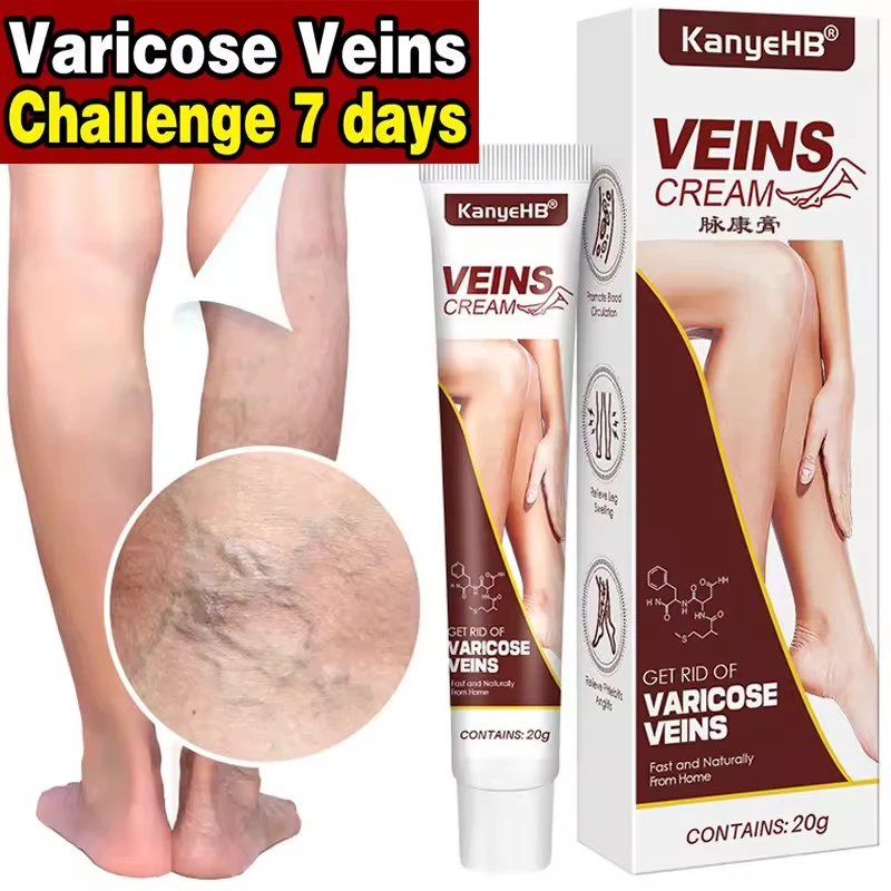 Varicose Veins Treatment Cream Leg Vein Skin Herbal Care Ointment Anti-swelling Varicocele Varices Medical Plaster Leg Care Tool
